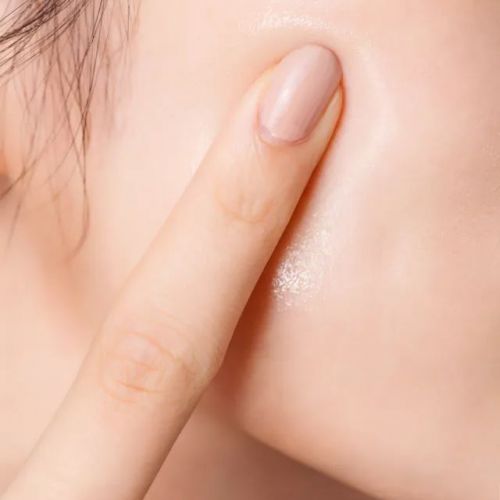 Giải Mã Làn Da: Cách Nhận Biết và Xử Lý Da Khô – Da Thiếu Nước