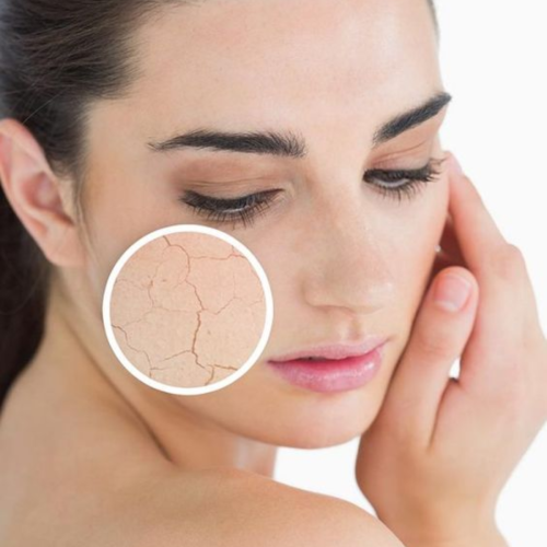 QUY TRÌNH CHĂM SÓC DA KHÔ CĂNG BÓNG HIỆU QUẢ TẠI NHÀ