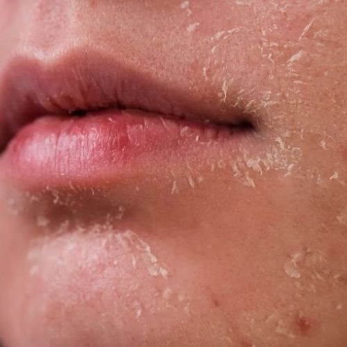 CÁCH DƯỠNG DA MÙA ĐÔNG CĂNG BÓNG HIỆU QUẢ 